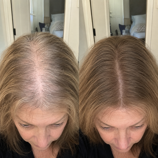 Less Thinning, More Confidence